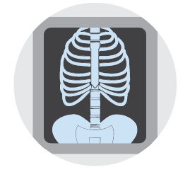 Image of an x-ray, which uses a small amount of radiation to create pictures of the inside of the body.