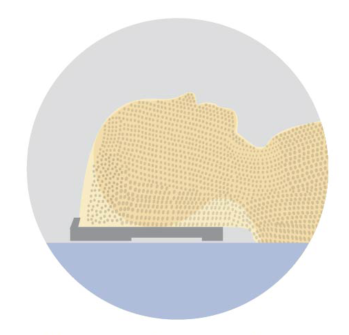 Illustration of a person wearing a fitted radiation therapy mask, with text saying many people get used to wearing a mask during treatment. 