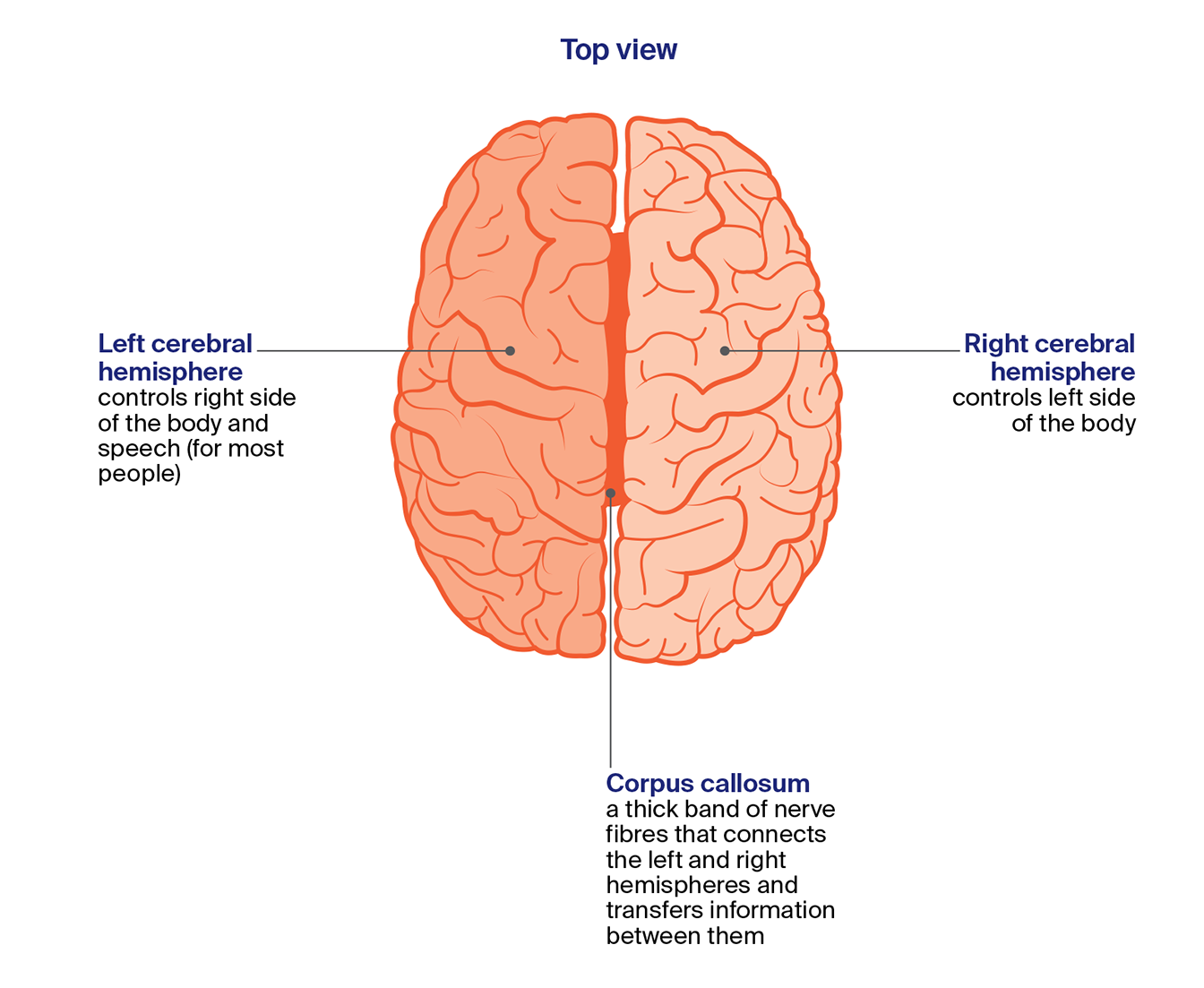 Top view of the brain showing the left and right sides and the corpus callosum that connects them and helps them share information.