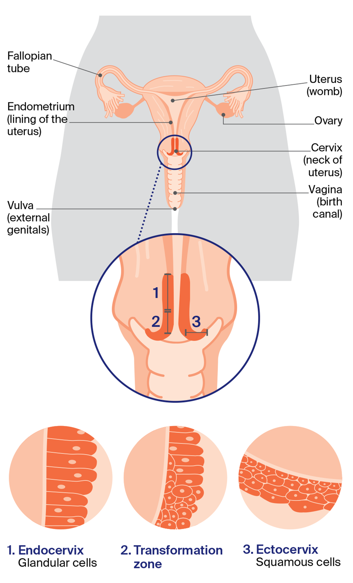 Diagram of the reproductive system including a close-up of the cervix, cell types and the meeting point transformation zone.