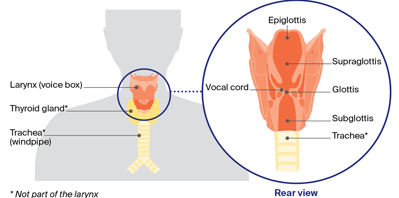 Diagram of the larynx (voice box) showing the epiglottis, vocal cords, supraglottis, glottis and subglottis, with the trachea below.