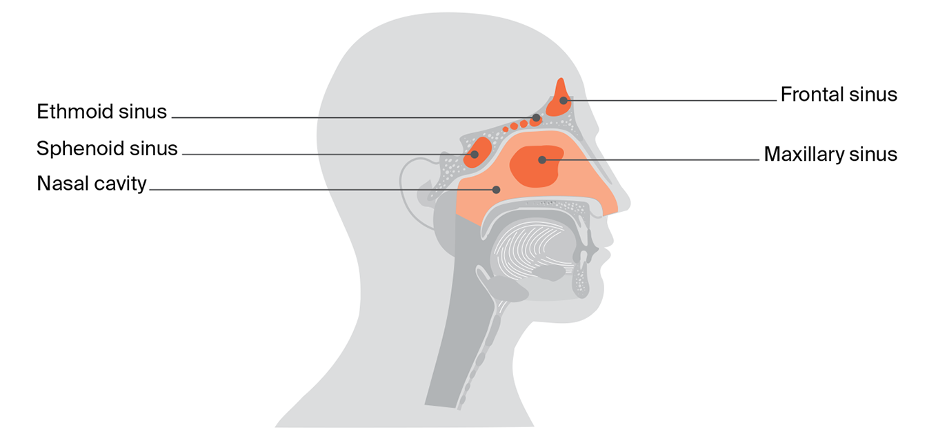 Diagram of the nasal cavity and sinuses showing the frontal, maxillary, ethmoid and sphenoid sinuses, and the nasal cavity inside the nose.