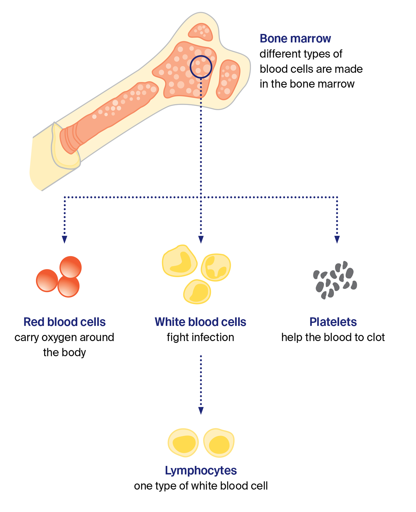 Diagram showing that different blood cells are made in the bone marrow. Arrows from a cross-section of bone marrow point to three blood cell types: red blood cells, which carry oxygen around the body; white blood cells, which fight infection; and platelets, which help blood clot. A further arrow shows that lymphocytes are one type of white blood cell.