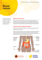 Thumbnail image of a fact sheet about bowel cancer