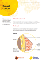 Thumbnail image of a fact sheet about breast cancer